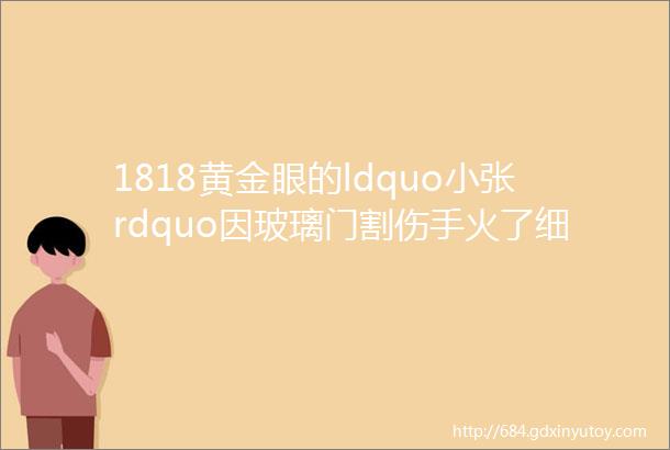 1818黄金眼的ldquo小张rdquo因玻璃门割伤手火了细数那些年1818黄金眼男团